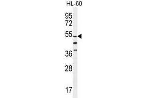 CO044 Antibody (C-term) western blot analysis in HL-60 cell line lysates (35µg/lane). (CO044 (AA 358-387), (C-Term) 抗体)