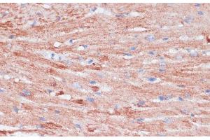 Immunohistochemistry (Paraffin-embedded Sections) (IHC (p)) image for anti-Vasodilator-Stimulated phosphoprotein (VASP) antibody (ABIN7257730)