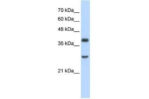 Human Jurkat; WB Suggested Anti-WDR39 Antibody Titration: 2. (CIAO1 抗体  (C-Term))