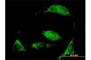 Immunofluorescence of purified MaxPab antibody to MCCC2 on HeLa cell. (MCCC2 抗体  (AA 1-563))