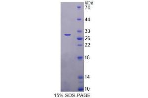 SDS-PAGE of Protein Standard from the Kit (Highly purified E. (ITGB6 CLIA Kit)