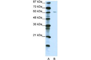 WB Suggested Anti-ZNF286 Antibody Titration:  1. (ZNF286A 抗体  (C-Term))