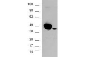 HEK293 overexpressing ERK1 and probed with ABIN2562467 (mock transfection in second lane) (ERK1 抗体  (N-Term))