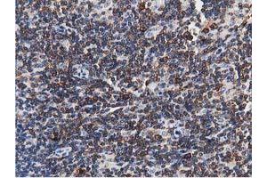 Image no. 9 for anti-Transforming, Acidic Coiled-Coil Containing Protein 3 (TACC3) antibody (ABIN1498095) (TACC3 抗体)