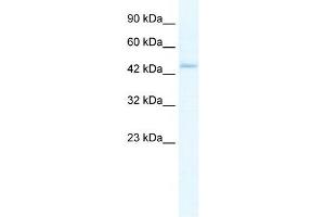 ZBP1 antibody used at 5 ug/ml to detect target protein. (ZBP1 抗体  (Middle Region))