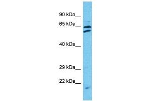 Western Blotting (WB) image for anti-Tetratricopeptide Repeat Domain 24 (TTC24) (C-Term) antibody (ABIN2791966) (TTC24 抗体  (C-Term))