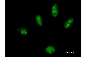 Immunofluorescence of purified MaxPab antibody to ZBTB25 on HeLa cell. (ZBTB25 抗体  (AA 1-435))