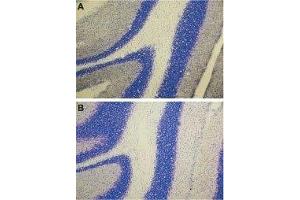 Immunohistochemistry (IHC) image for anti-Endothelin Receptor Type A (EDNRA) (AA 413-426), (Intracellular) antibody (ABIN7043119)