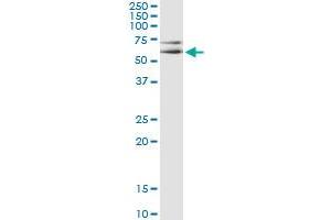 Western Blotting (WB) image for anti-Mitogen-Activated Protein Kinase 8 (MAPK8) (AA 318-428) antibody (ABIN793072) (JNK 抗体  (AA 318-428))