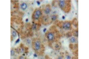 Used in DAB staining on fromalin fixed paraffin-embedded Liver tissue