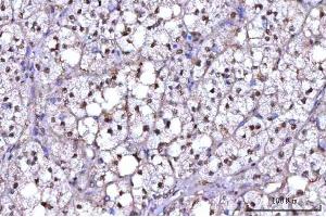 IHC analysis of RNF34 using anti-RNF34 antibody (ABIN7602457).