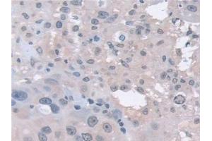 Immunohistochemistry (IHC) image for anti-Proteasome Subunit alpha 5 (PSMA5) (AA 1-241) antibody (ABIN7441322)