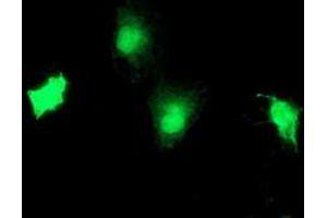 Anti-TBCC mouse monoclonal antibody (ABIN2455773) immunofluorescent staining of COS7 cells transiently transfected by pCMV6-ENTRY TBCC (RC203563). (TBCC 抗体)