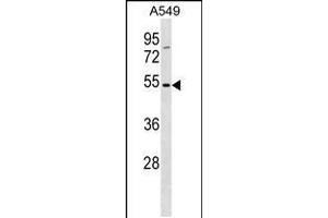 Western blot analysis in A549 cell line lysates (35ug/lane). (TM6SF1 抗体  (N-Term))