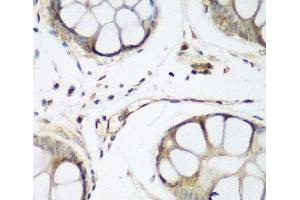 Immunohistochemistry of paraffin-embedded Human gastric using TAZ Polyclonal Antibody at dilution of 1:200 (40x lens). (TAZ 抗体)