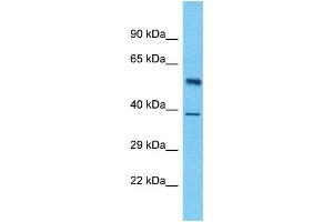 Host:  Rabbit  Target Name:  LUC7L3  Sample Type:  Pancreas Tumor lysates  Antibody Dilution:  1. (LUC7-Like 3 抗体  (Middle Region))