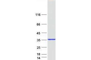 Cytochrome B5 Reductase 3 (CYB5R3) (Transcript Variant 2) protein (Myc-DYKDDDDK Tag)