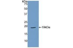 Detection of Recombinant RLN, Mouse using Polyclonal Antibody to Relaxin (RLN) (Relaxin 抗体  (AA 25-181))