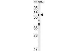 Western Blotting (WB) image for anti-Transforming Growth Factor, beta Receptor II (70/80kDa) (TGFBR2) (AA 20-48), (N-Term) antibody (ABIN955177)
