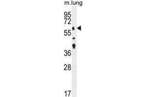 TGFBR2 Antibody (N-term) western blot analysis in mouse lung tissue lysates (35 µg/lane). (TGFBR2 抗体  (N-Term))