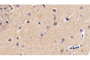 Immunohistochemistry (IHC) image for anti-Calponin 1 (CNN1) (AA 1-268) antibody (ABIN7436681)