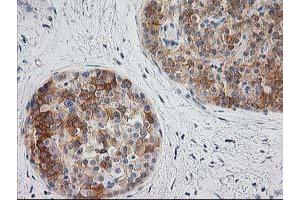 Image no. 7 for anti-BAI1-Associated Protein 2 (BAIAP2) antibody (ABIN1496805) (BAIAP2 抗体)