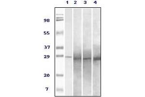 Western Blotting (WB) image for anti-RAB25, Member RAS Oncogene Family (RAB25) antibody (ABIN2464096) (RAB25 抗体)