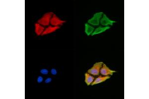 ABIN6259675 and ABIN6279158 staining HepG2 cells by IF/ICC. (ABCA12 抗体  (C-Term))