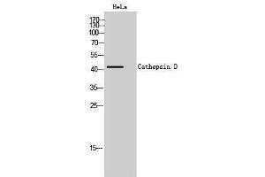 Western Blotting (WB) image for anti-Cathepsin D (CTSD) (Internal Region) antibody (ABIN3183691) (Cathepsin D 抗体  (Internal Region))