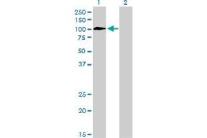 Western Blot analysis of TYRO3 expression in transfected 293T cell line by TYRO3 monoclonal antibody (M05), clone 4F6. (TYRO3 抗体  (AA 50-150))