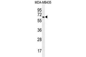 PRAMEF20 Antibody (C-term) western blot analysis in MDA-MB435 cell line lysates (35µg/lane). (PRAMEF20 抗体  (C-Term))