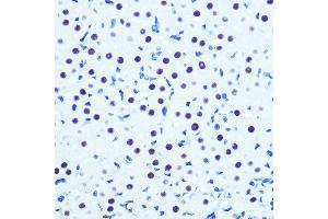 Immunohistochemistry (IHC) image for anti-Cyclin-Dependent Kinase 9 (CDK9) antibody (ABIN7266597)