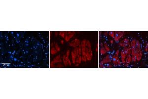 Rabbit Anti-Zfr Antibody  Catalog Number: ARP39226_P050 Formalin Fixed Paraffin Embedded Tissue: Human Adult heart  Observed Staining: Cytoplasmic Primary Antibody Concentration: 1:600 Secondary Antibody: Donkey anti-Rabbit-Cy2/3 Secondary Antibody Concentration: 1:200 Magnification: 20X Exposure Time: 0. (ZFR 抗体  (N-Term))