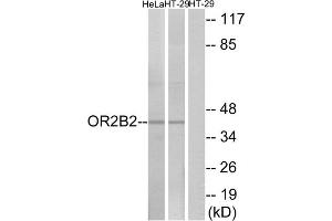 Western blot analysis of extracts from HeLa cells and HT-29 cells, using OR2B2 antibody. (OR2B2 抗体  (Internal Region))
