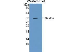 Western blot analysis of the recombinant protein. (ROS1 抗体  (AA 1937-2210))