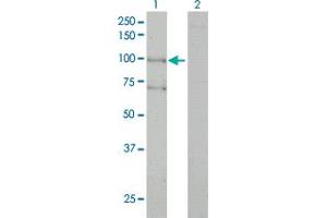 Western Blot analysis of ALS2 expression in transfected 293T cell line by ALS2 monoclonal antibody (M01), clone 4F9. (ALS2 抗体  (AA 221-320))
