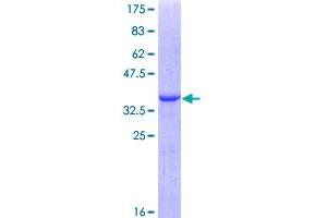 Granulin Protein (GRN) (AA 494-593) (GST tag)