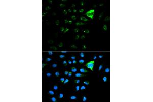 Immunofluorescence analysis of MCF-7 cells using CDKN1A antibody. (p21 抗体)