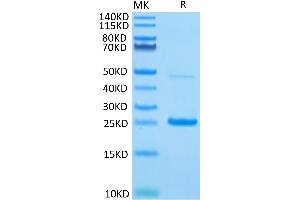 IL17C Protein (AA 19-197) (His-Avi Tag)