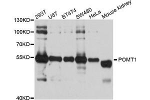 Western blot analysis of extract of various cells, using POMT1 antibody. (POMT1 抗体)