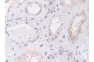 Detection of GLS in Human Kidney Tissue using Polyclonal Antibody to Glutaminase (GLS) (Glutaminase 抗体  (AA 221-533))