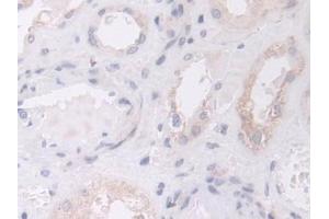 Detection of GLS in Human Kidney Tissue using Polyclonal Antibody to Glutaminase (GLS)