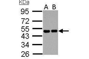 WB Image RCC1 antibody detects RCC1 protein by Western blot analysis. (RCC1 抗体)