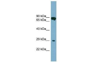 CYB5D1 antibody used at 1 ug/ml to detect target protein. (CYB5D1 抗体  (Middle Region))