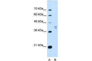 PSAT1 antibody used at 1 ug/ml to detect target protein. (PSAT1 抗体  (N-Term))