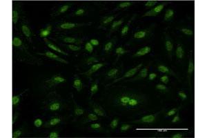 Immunofluorescence of monoclonal antibody to CSE1L on HeLa cell. (Exportin 2 抗体  (AA 872-971))