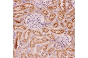 Anti-P Glycoprotein Picoband antibody,  IHC(P): Rat Kidney Tissue (ABCB1 抗体  (Middle Region))