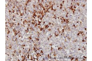 Immunoperoxidase of monoclonal antibody to APOA2 on formalin-fixed paraffin-embedded human malignant lymphoma, diffuse large B. (APOA2 抗体  (AA 1-100))