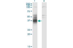 Western Blot analysis of TMIGD1 expression in transfected 293T cell line by TMIGD1 monoclonal antibody (M01), clone 4A8. (TMIGD1 抗体  (AA 1-262))