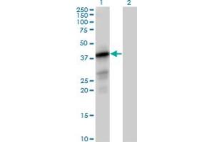 Western Blot analysis of PTPLAD1 expression in transfected 293T cell line by PTPLAD1 MaxPab polyclonal antibody. (PTPLAD1 抗体  (AA 1-362))
